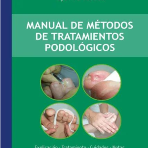 Métodos de tratamientos podológicos