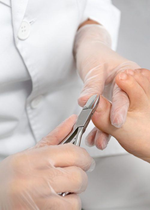 Close up of a chiropodist's hands doing chiropody in her podiatry clinic. The chiropodist is cutting the patient's nails with specialized scissors
