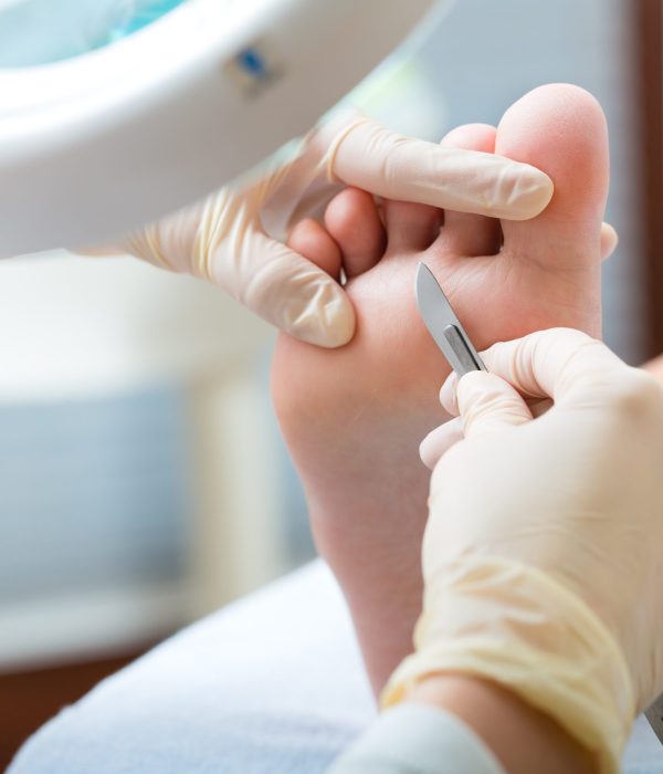 Woman receiving podiatry treatment in a Day Spa